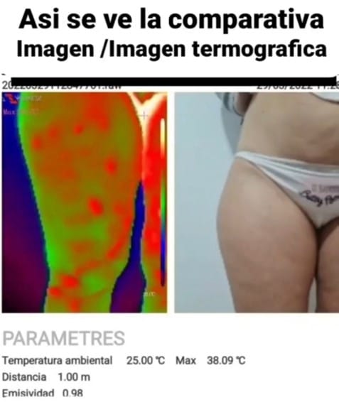 comparativa imagen termografica- centro estetica barcelona carmen secrets