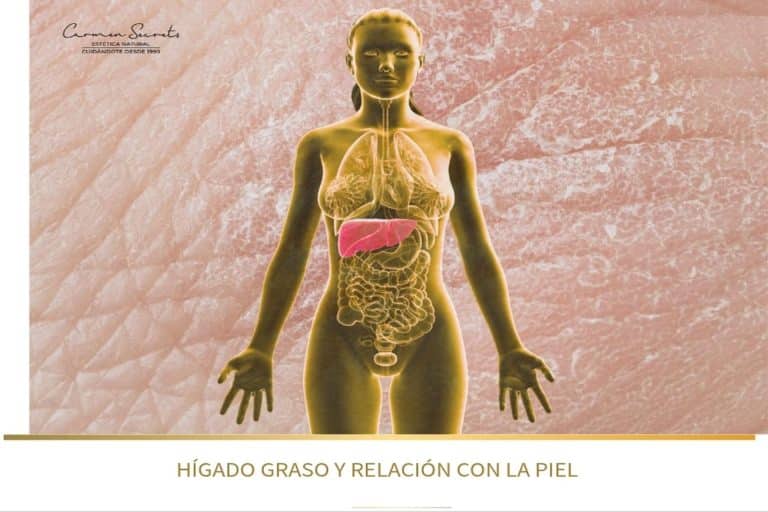 Ilustración del hígado graso y su relación con la piel