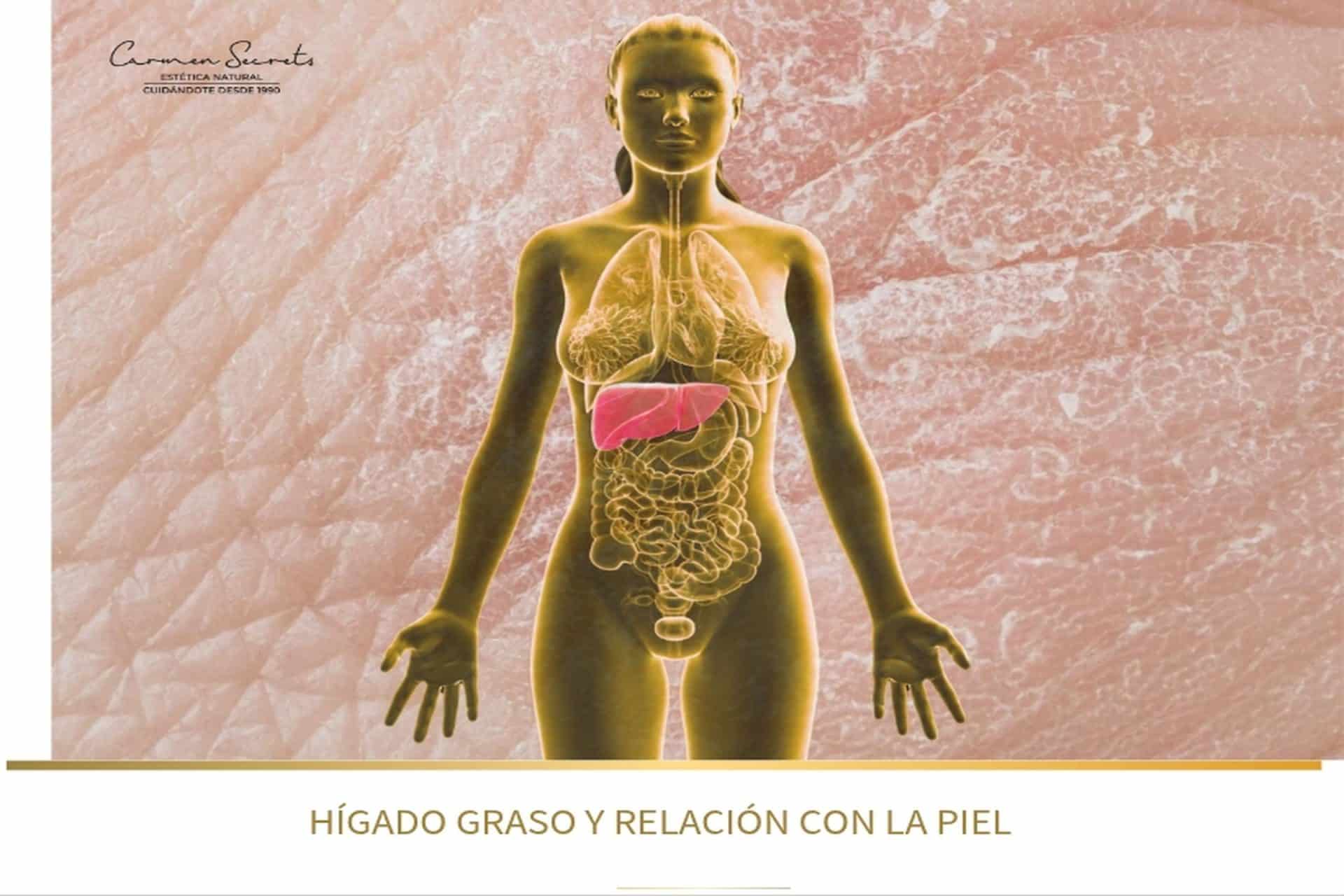 Ilustración del hígado graso y su relación con la piel